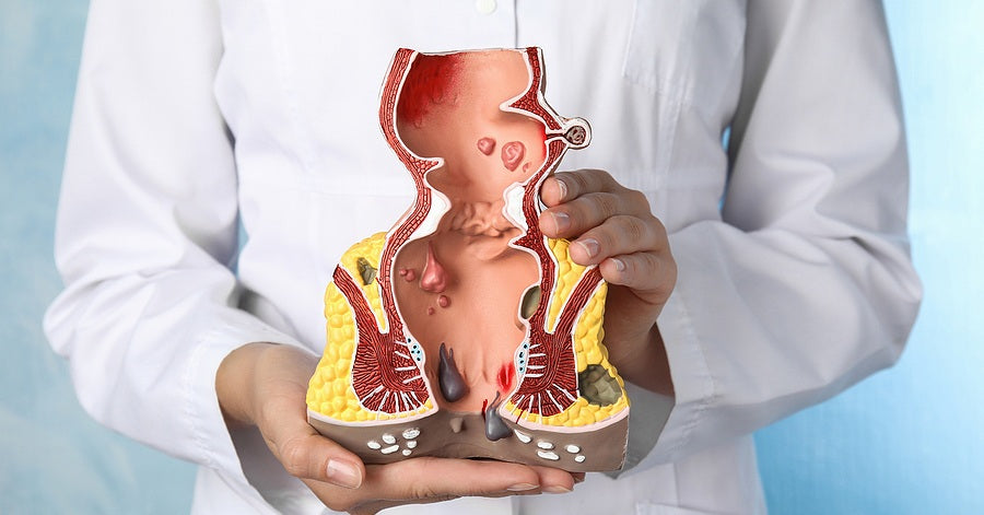 Soothe and Heal: Understanding the Ingredients in Tushé for Hemorrhoid Relief