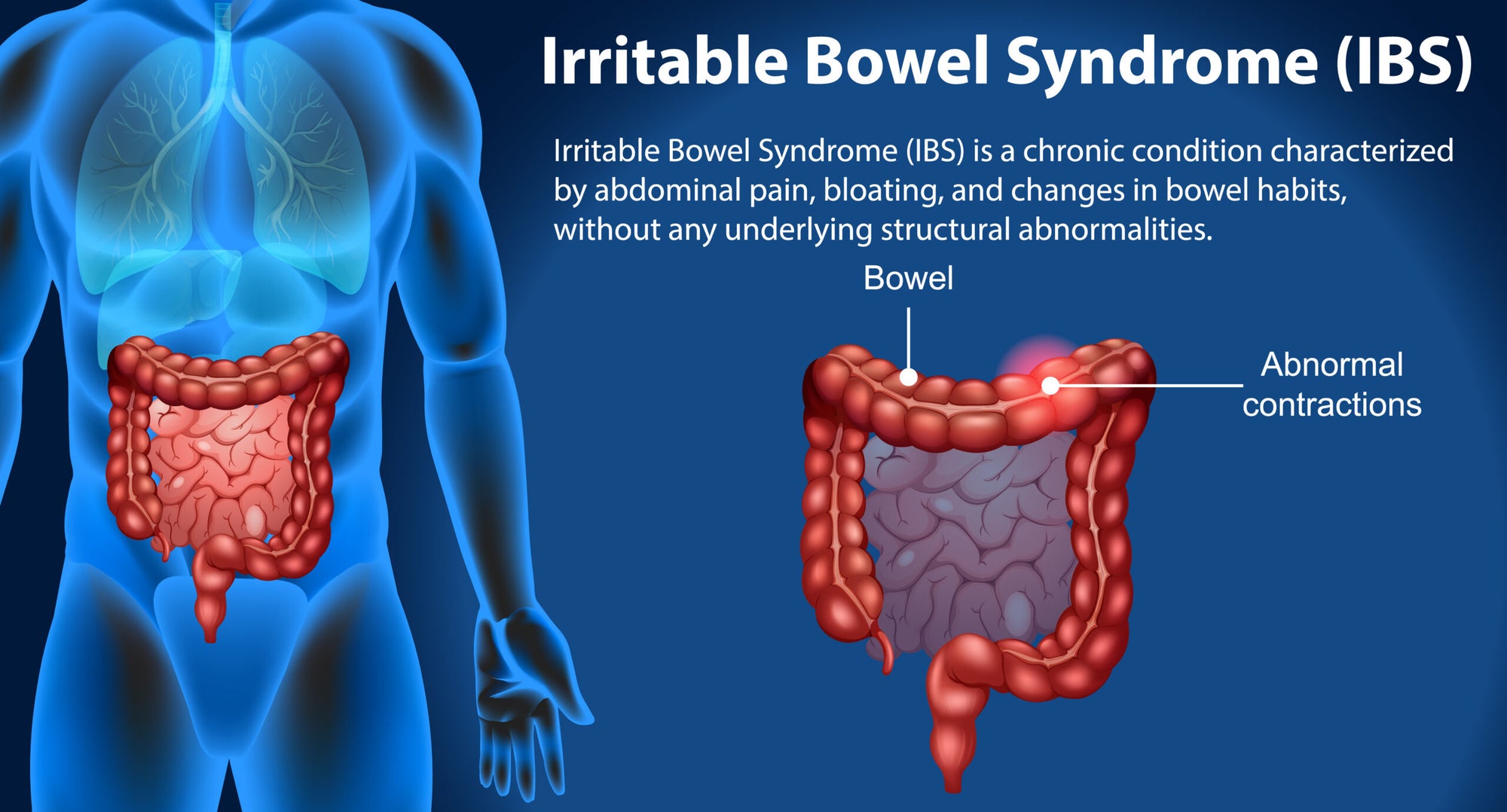 How Tushé Supports Individuals with Irritable Bowel Syndrome (IBS)